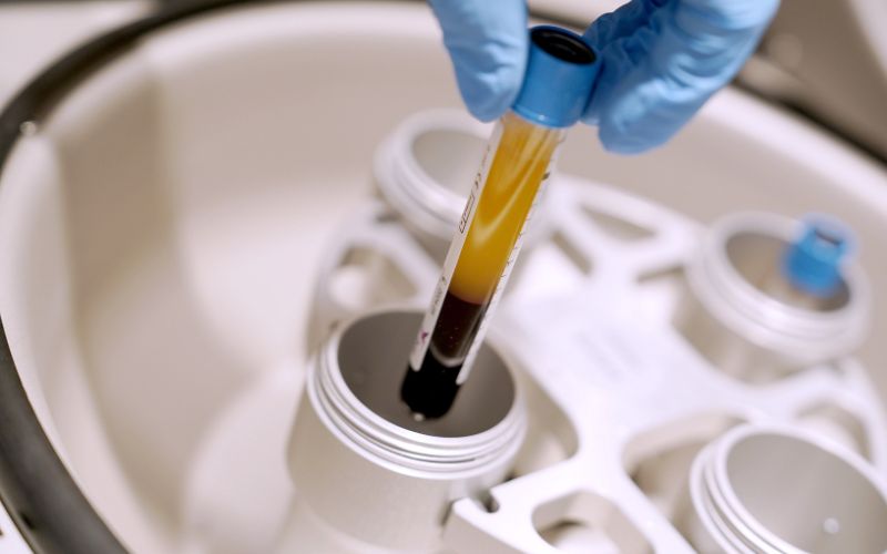 Tratamientos de medicina regenerativa