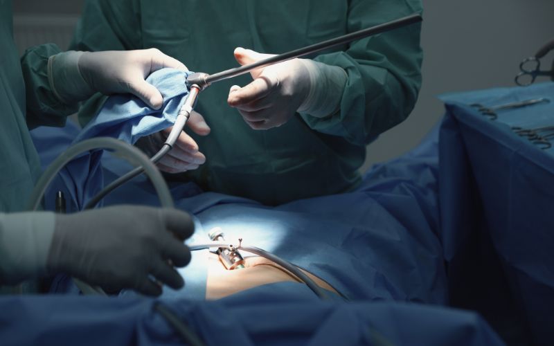 Cirugia Digestiva